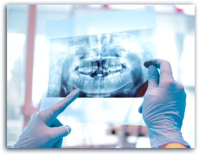 Stomatolog ogląda zdjęcie RTF zębów